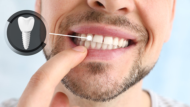 The image shows a man with a toothbrush in his mouth, examining his teeth closely.