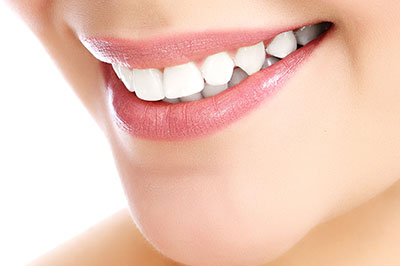 The image shows a close-up of a person s face with a focus on their teeth and lips, highlighting dental care or cosmetic dentistry.