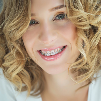 Smiling woman with straightened teeth, wearing a white top and curly hair, posing for portrait.