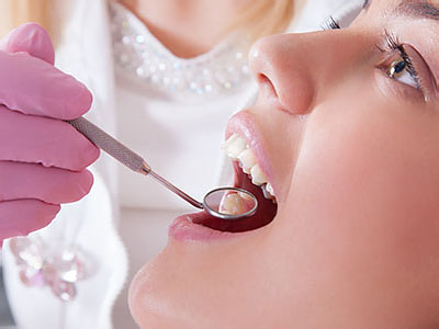 A dental professional performing a procedure on a patient s mouth, with the patient wearing purple gloves and a white lab coat.